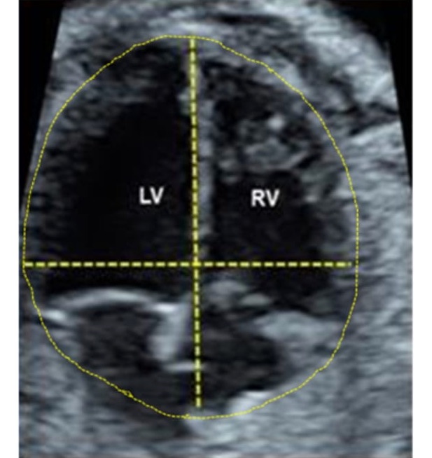 Calculadoras | Medicina Fetal Barcelona