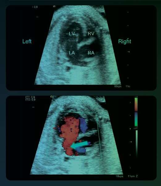 Curso abierto Avanzado en Cardiología Fetal [ES]